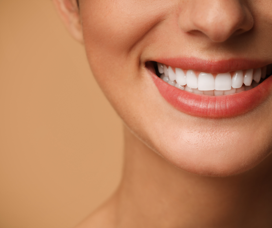 10 Reasons People Choose Veneers (And Not All Are Cosmetic)